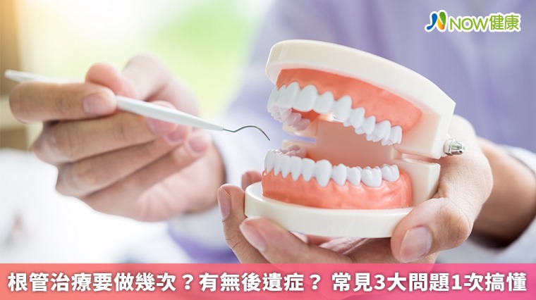 根管治療要做幾次?有無後遺症? 常見3大問題1次搞懂 根管治療要做幾次?有無後遺症? 常見3大問題1次搞懂