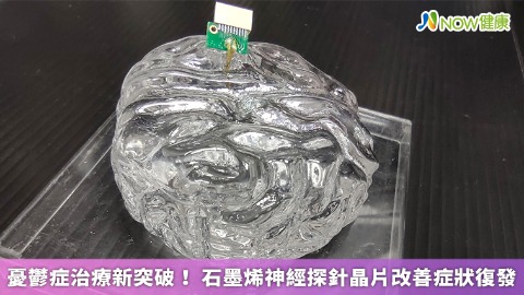 憂鬱症治療新突破！ 石墨烯神經探針晶片改善症狀復發