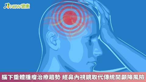 腦下垂體腫瘤治療趨勢 經鼻內視鏡取代傳統開顱降風險