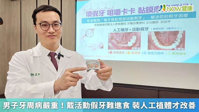 男子牙周病嚴重!戴活動假牙難進食 裝人工植體才改善 男子牙周病嚴重!戴活動假牙難進食 裝人工植體才改善