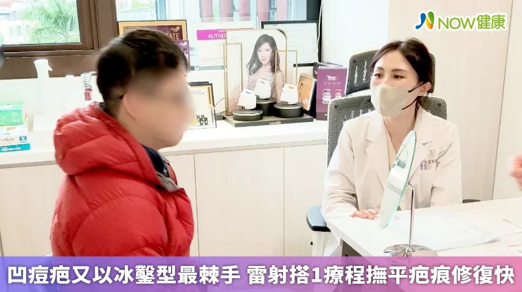 凹痘疤又以冰鑿型最棘手 雷射搭1療程撫平疤痕修復快 凹痘疤又以冰鑿型最棘手 雷射搭1療程撫平疤痕修復快