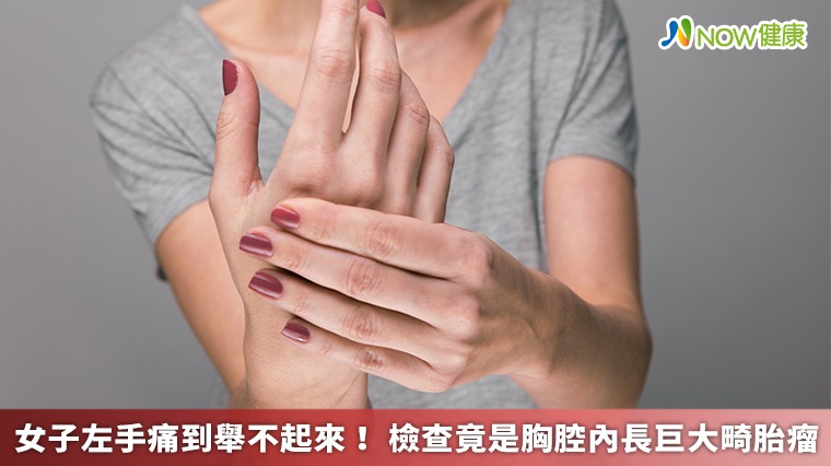 女子左手痛到舉不起來! 檢查竟是胸腔內長巨大畸胎瘤 女子左手痛到舉不起來! 檢查竟是胸腔內長巨大畸胎瘤