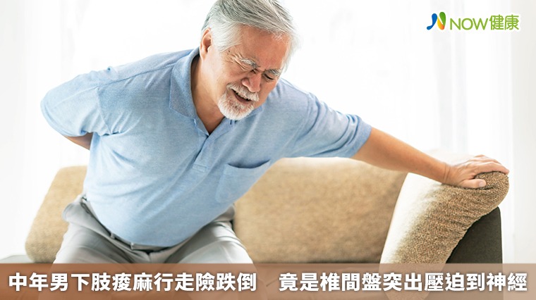 中年男下肢痠麻行走險跌倒 竟是椎間盤突出壓迫到神經 中年男下肢痠麻行走險跌倒 竟是椎間盤突出壓迫到神經
