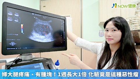 婦大腿疼痛、有腫塊！1週長大1倍 化驗竟是這種惡性瘤