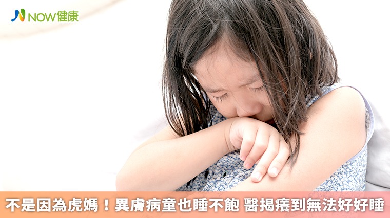 不是因為虎媽!異膚病童也睡不飽 醫揭癢到無法好好睡 不是因為虎媽!異膚病童也睡不飽 醫揭癢到無法好好睡