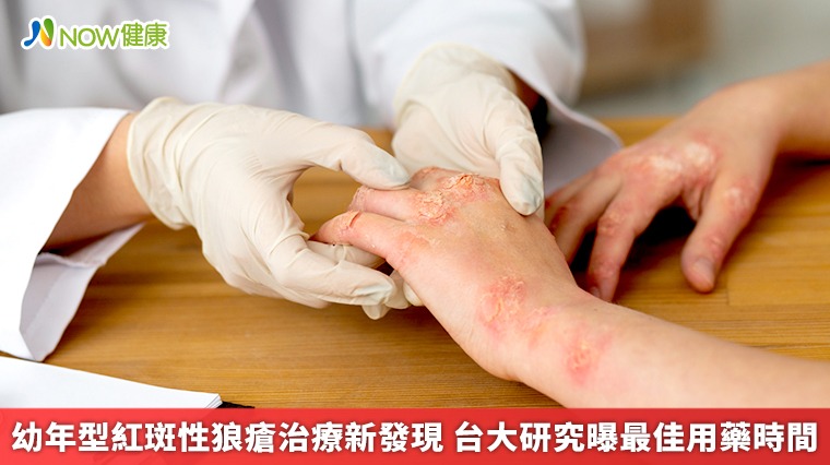 幼年型紅斑性狼瘡治療新發現 台大醫研究曝最佳用藥時間 幼年型紅斑性狼瘡治療新發現 台大醫研究曝最佳用藥時間