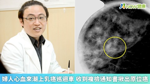 婦人心血來潮上乳癌巡迴車 收到複檢通知書揪出原位癌