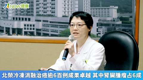 北榮冷凍消融治癌逾6百例成果卓越 其中腎臟腫瘤占6成