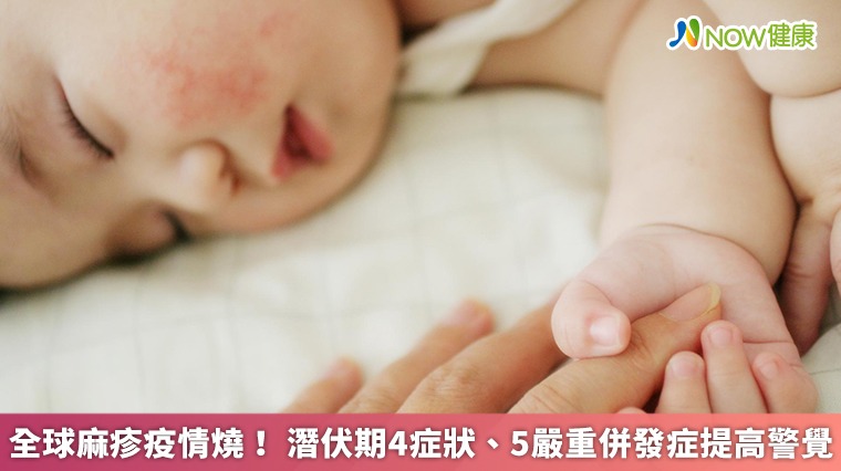 全球麻疹疫情燒! 潛伏期4症狀、5嚴重併發症提高警覺 全球麻疹疫情燒! 潛伏期4症狀、5嚴重併發症提高警覺