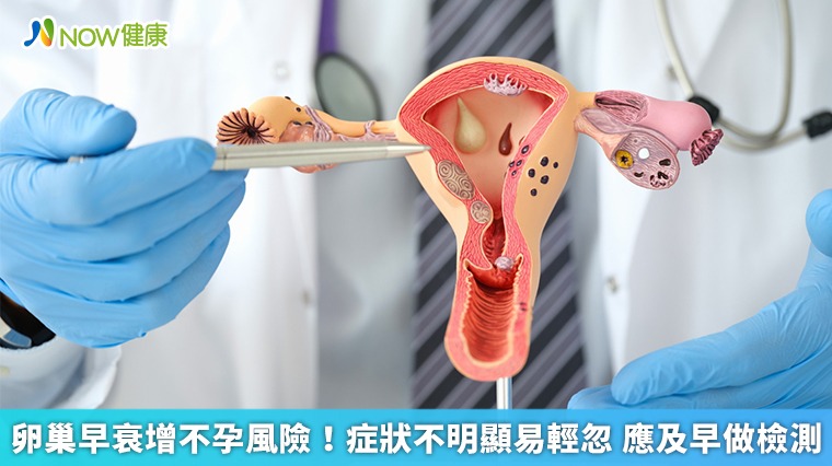 卵巢早衰增不孕風險!症狀不明顯易輕忽 應及早做檢測 卵巢早衰增不孕風險!症狀不明顯易輕忽 應及早做檢測