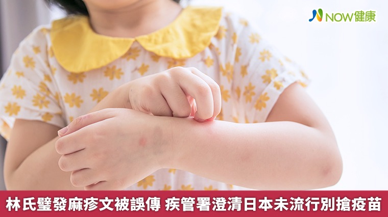 林氏璧發麻疹文被誤傳 疾管署澄清日本未流行別搶疫苗 林氏璧發麻疹文被誤傳 疾管署澄清日本未流行別搶疫苗