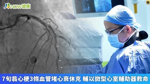 7旬翁心梗3條血管堵心衰休克 輔以微型心室輔助器救命