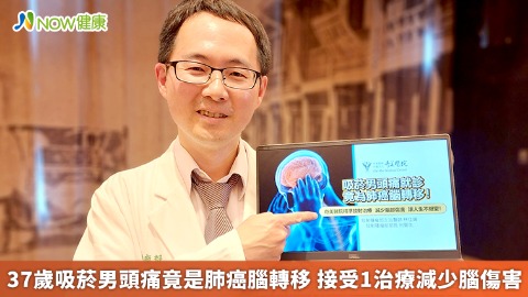 37歲吸菸男頭痛竟是肺癌腦轉移 接受1治療減少腦傷害