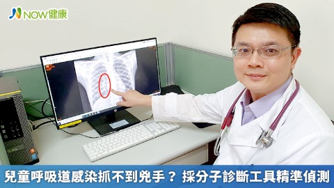 兒童呼吸道感染抓不到兇手？ 採分子診斷工具精準偵測