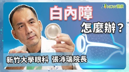 視力模糊是近視加深？ 醫曝有這些症狀恐白內障