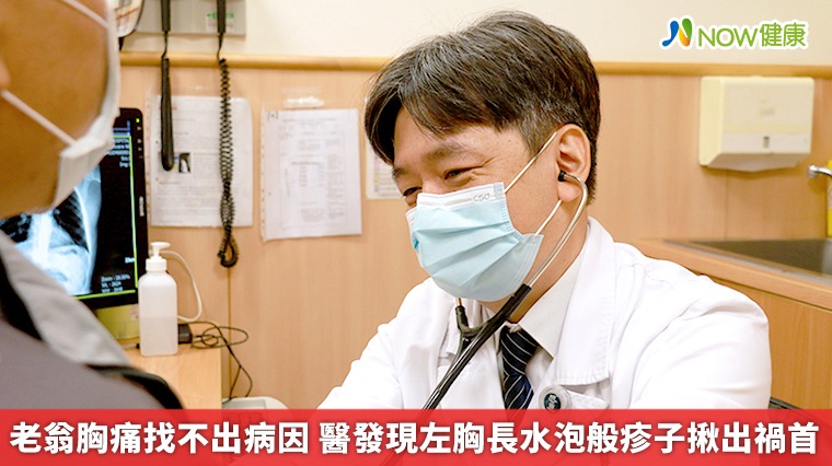 老翁胸痛找不出病因 醫發現左胸長水泡般疹子揪出禍首 老翁胸痛找不出病因 醫發現左胸長水泡般疹子揪出禍首