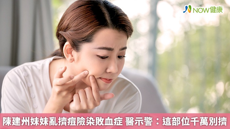 陳建州妹妹亂擠痘險染敗血症 醫示警:這部位千萬別擠 陳建州妹妹亂擠痘險染敗血症 醫示警:這部位千萬別擠