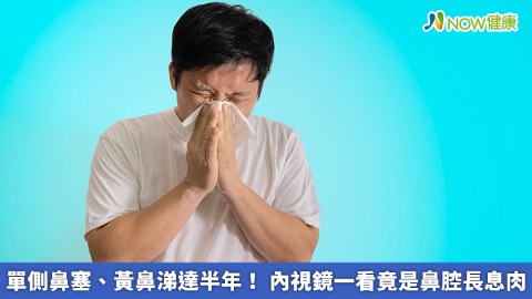 單側鼻塞、黃鼻涕達半年！ 內視鏡一看竟是鼻腔長息肉