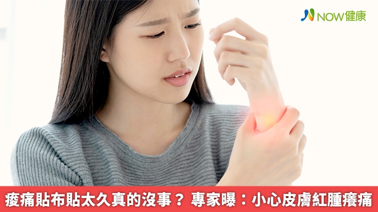 痠痛貼布貼太久真的沒事? 專家曝:小心皮膚紅腫癢痛 痠痛貼布貼太久真的沒事? 專家曝:小心皮膚紅腫癢痛