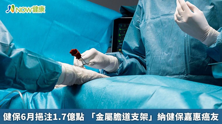 健保6月挹注1.7億點 「金屬膽道支架」納健保嘉惠癌友