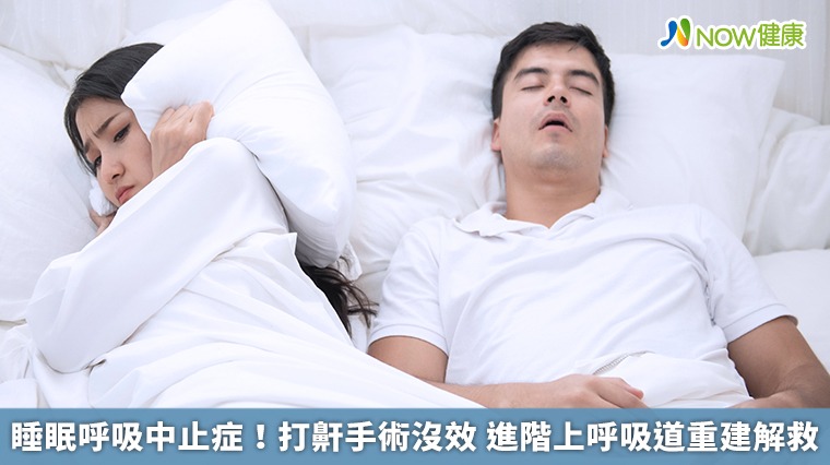 睡眠呼吸中止症!打鼾手術沒效 進階上呼吸道重建解救 睡眠呼吸中止症!打鼾手術沒效 進階上呼吸道重建解救