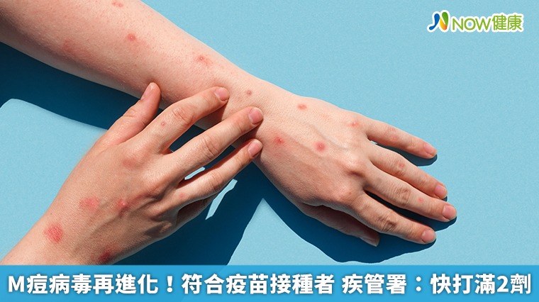 M痘病毒再進化!符合疫苗接種者 疾管署:快打滿2劑 M痘病毒再進化!符合疫苗接種者 疾管署:快打滿2劑