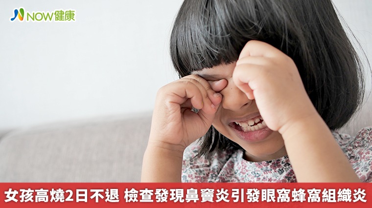 女孩高燒2日不退 檢查發現鼻竇炎引發眼窩蜂窩組織炎 女孩高燒2日不退 檢查發現鼻竇炎引發眼窩蜂窩組織炎