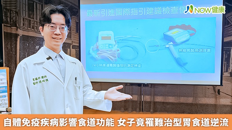 自體免疫疾病影響食道功能 女子竟罹難治型胃食道逆流 自體免疫疾病影響食道功能 女子竟罹難治型胃食道逆流