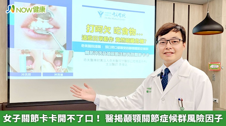 女子關節卡卡開不了口! 醫揭顳顎關節症候群風險因子 女子關節卡卡開不了口! 醫揭顳顎關節症候群風險因子