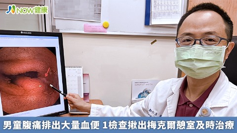 男童腹痛排出大量血便 1檢查揪出梅克爾憩室及時治療