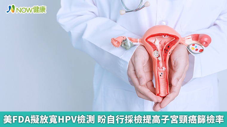 美FDA擬放寬HPV檢測 盼自行採檢提高子宮頸癌篩檢率 美FDA擬放寬HPV檢測 盼自行採檢提高子宮頸癌篩檢率