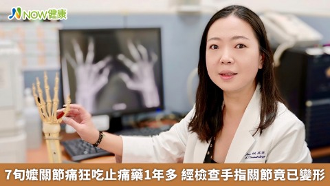 7旬嬤關節痛狂吃止痛藥1年多 經檢查手指關節竟已變形