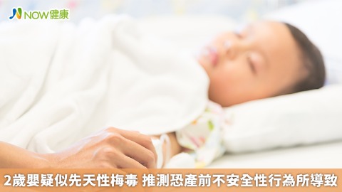 2歲嬰疑似先天性梅毒 推測恐產前不安全性行為所導致