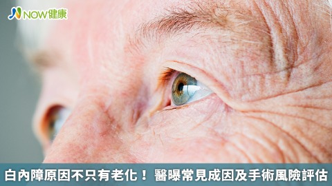 白內障原因不只有老化！ 醫曝常見成因及手術風險評估