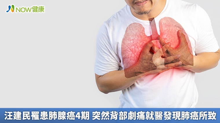 汪建民罹患肺腺癌4期 突然背部劇痛就醫發現肺癌所致 汪建民罹患肺腺癌4期 突然背部劇痛就醫發現肺癌所致