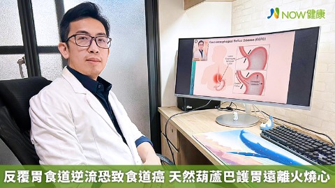 反覆胃食道逆流恐致食道癌 天然葫蘆巴護胃遠離火燒心