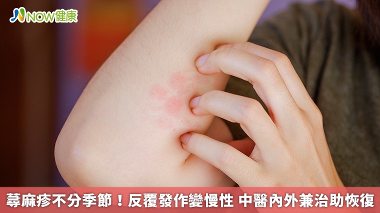 蕁麻疹不分季節!反覆發作變慢性 中醫內外兼治助恢復 蕁麻疹不分季節!反覆發作變慢性 中醫內外兼治助恢復