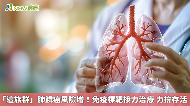 「這族群」肺鱗癌風險增!免疫標靶接力治療 力拚存活 「這族群」肺鱗癌風險增!免疫標靶接力治療 力拚存活