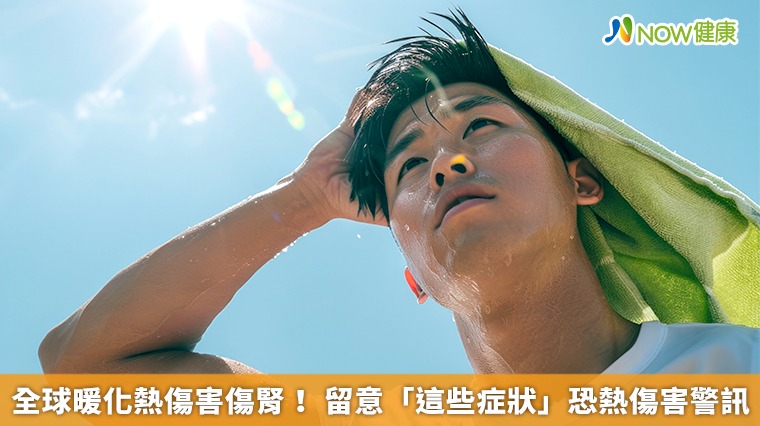 全球暖化熱傷害傷腎! 留意「這些症狀」恐熱傷害警訊 全球暖化熱傷害傷腎! 留意「這些症狀」恐熱傷害警訊