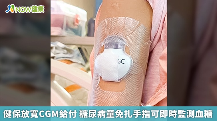 健保放寬CGM給付 糖尿病童免扎手指可即時監測血糖 健保放寬CGM給付 糖尿病童免扎手指可即時監測血糖