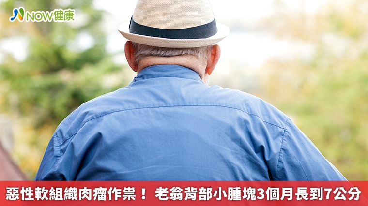 惡性軟組織肉瘤作祟! 老翁背部小腫塊3個月長到7公分 惡性軟組織肉瘤作祟! 老翁背部小腫塊3個月長到7公分