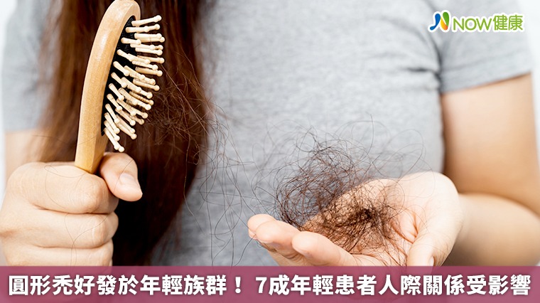 圓形禿好發於年輕族群! 7成年輕患者人際關係受影響 圓形禿好發於年輕族群! 7成年輕患者人際關係受影響
