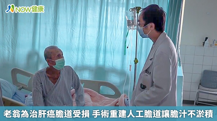 老翁為治肝癌膽道受損 手術重建人工膽道讓膽汁不淤積 老翁為治肝癌膽道受損 手術重建人工膽道讓膽汁不淤積