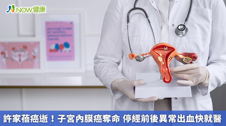 許家蓓癌逝!子宮內膜癌奪命 停經前後異常出血快就醫 許家蓓癌逝!子宮內膜癌奪命 停經前後異常出血快就醫