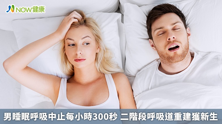 男睡眠呼吸中止每小時300秒 二階段呼吸道重建獲新生 男睡眠呼吸中止每小時300秒 二階段呼吸道重建獲新生