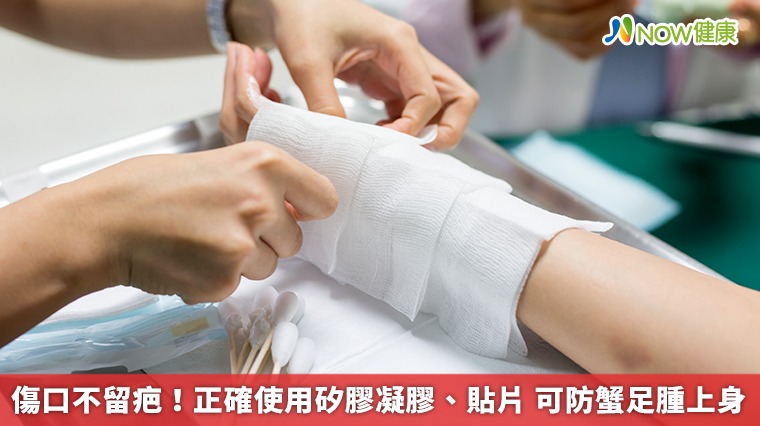 傷口不留疤!正確使用矽膠凝膠、貼片 可防蟹足腫上身 傷口不留疤!正確使用矽膠凝膠、貼片 可防蟹足腫上身