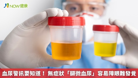 血尿警訊要知道！ 無症狀「顯微血尿」容易障眼難發覺