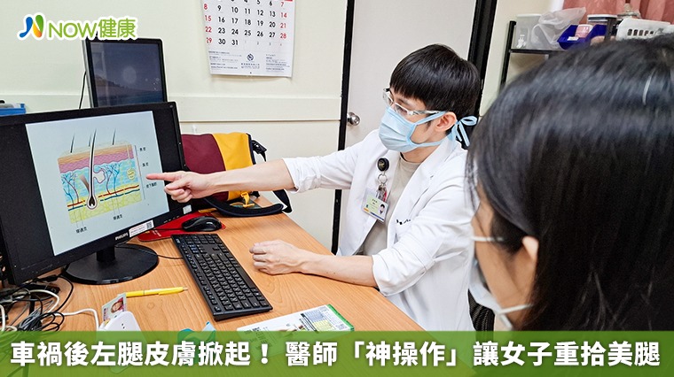 車禍後左腿皮膚掀起! 醫師「神操作」讓女子重拾美腿 車禍後左腿皮膚掀起! 醫師「神操作」讓女子重拾美腿
