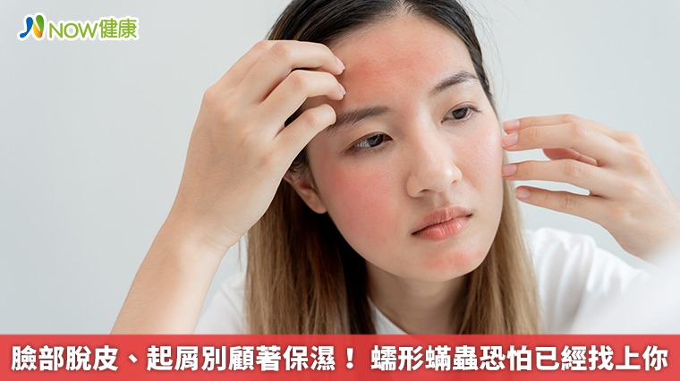 臉部脫皮、起屑別顧著保濕! 蠕形蟎蟲恐怕已經找上你 臉部脫皮、起屑別顧著保濕! 蠕形蟎蟲恐怕已經找上你
