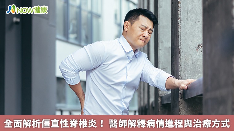 全面解析僵直性脊椎炎! 醫師解釋病情進程與治療方式 全面解析僵直性脊椎炎! 醫師解釋病情進程與治療方式